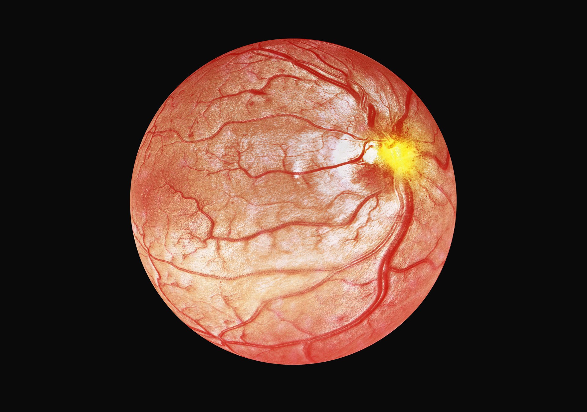 Applications medical optical coherence tomography